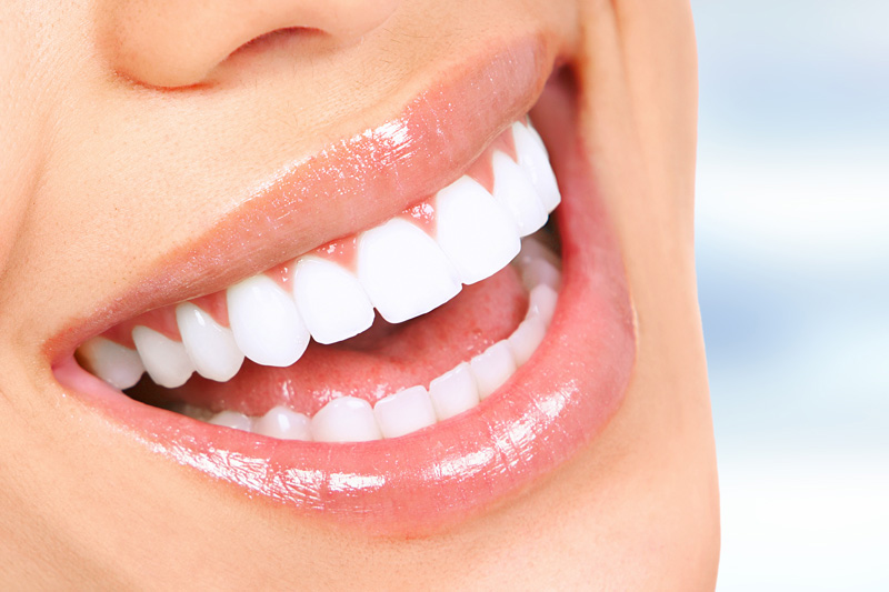 Cosmetic Dentistry in Santa Maria